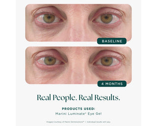 Marini Luminate® Eye Gel