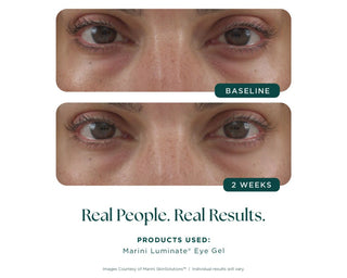 Marini Luminate® Eye Gel