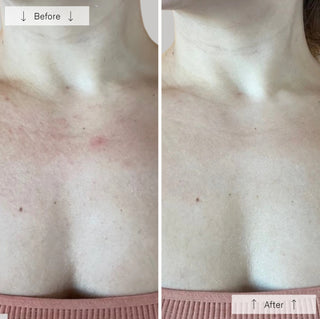 Omnilux Contour Neck & Décolleté