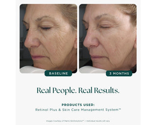 Age Intervention™ Retinol Plus