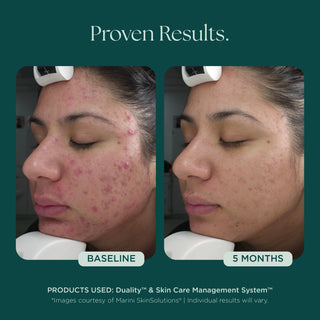 Marini SkinSolutions Age Intervention® Duality™ | Skin Bar by Mila