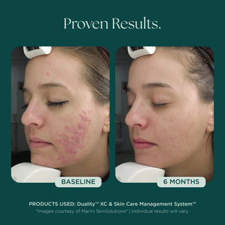 Marini SkinSolutions Age Intervention® Duality™ | Skin Bar by Mila