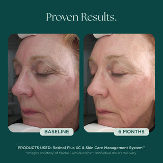 Marini SkinSolutions Age Intervention™ Retinol Plus | Skin Bar by Mila