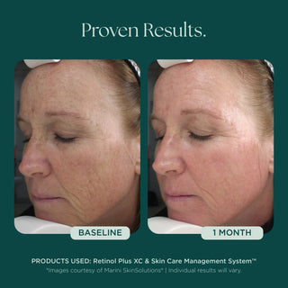 Marini SkinSolutions Age Intervention™ Retinol Plus | Skin Bar by Mila