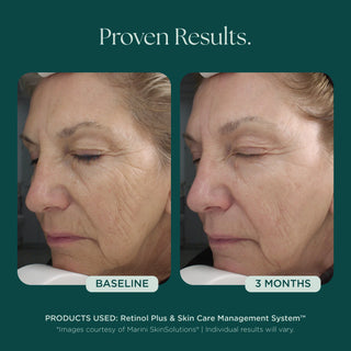 Marini SkinSolutions Age Intervention™ Retinol Plus | Skin Bar by Mila