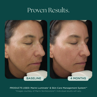 Marini SkinSolutions Luminate® Face Lotion | Skin Bar by Mila